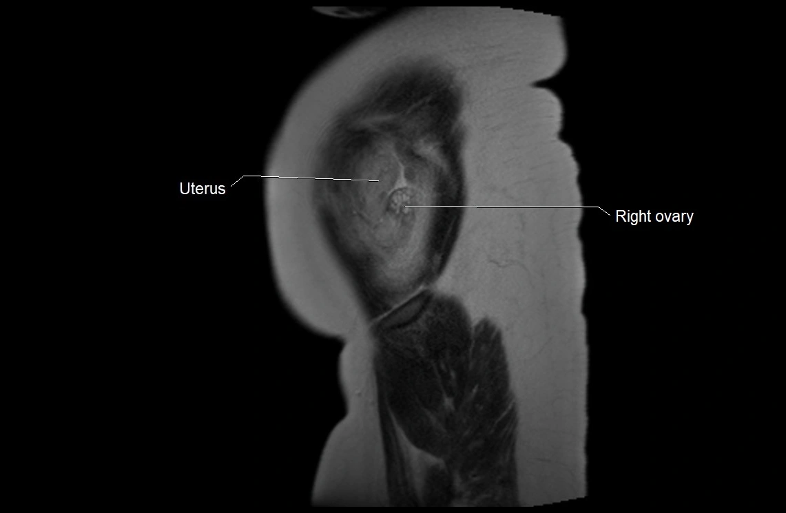 MRI fetal anatomy sagittal image 1.webp